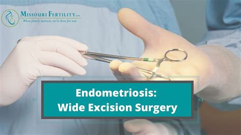 endometriosis excision surgery seattle